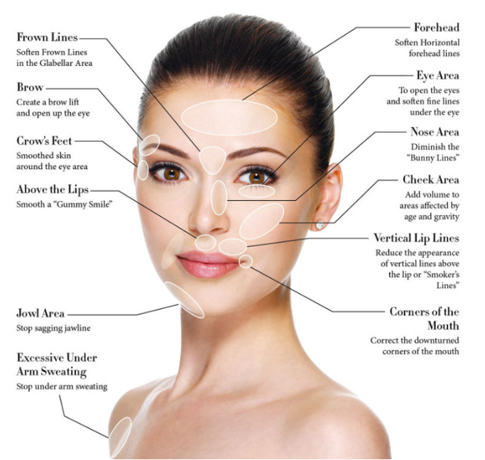 Botox rynkor läkare tandläkare varberg