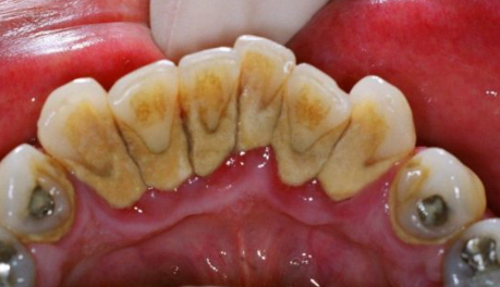 tandsten varberg tandläkare tandhygienist